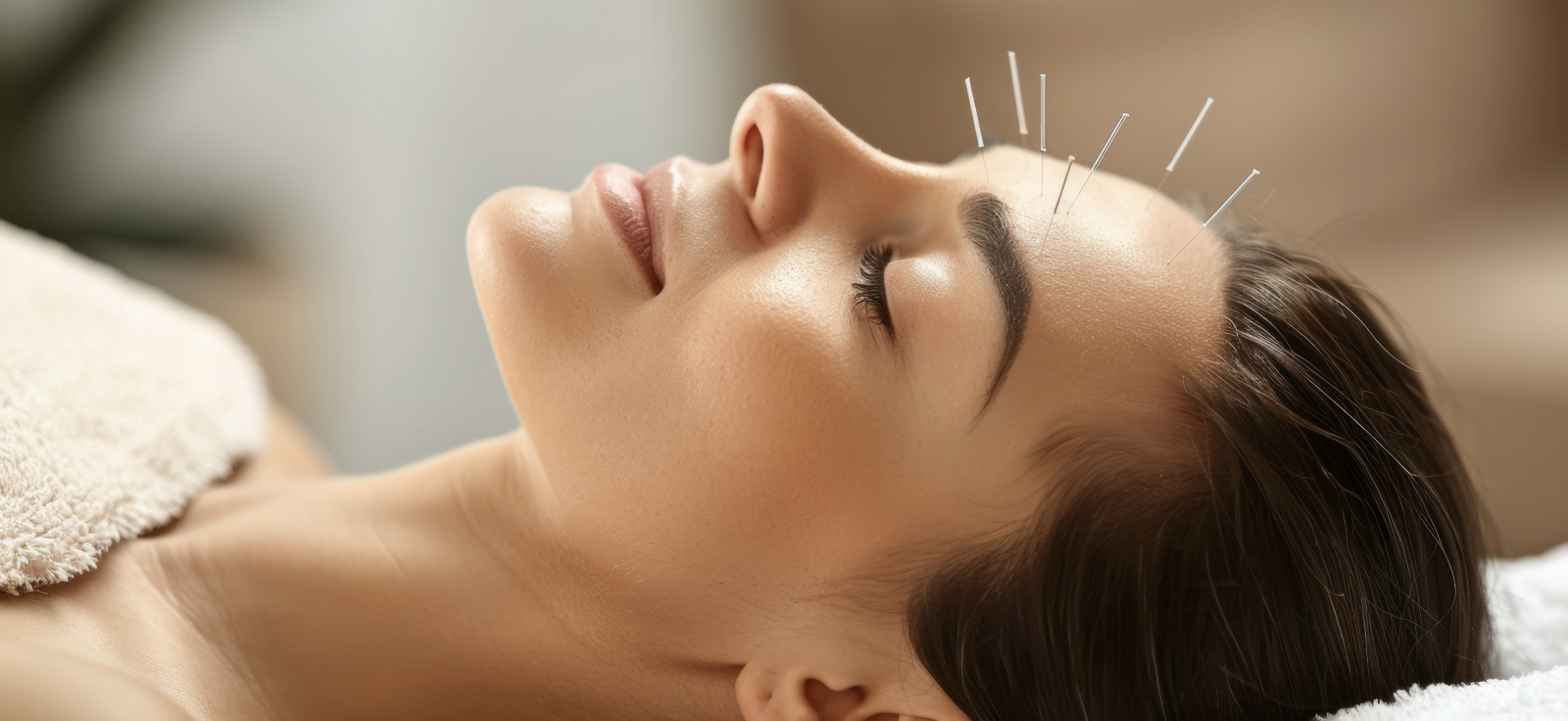 Acupuncture in Australia
